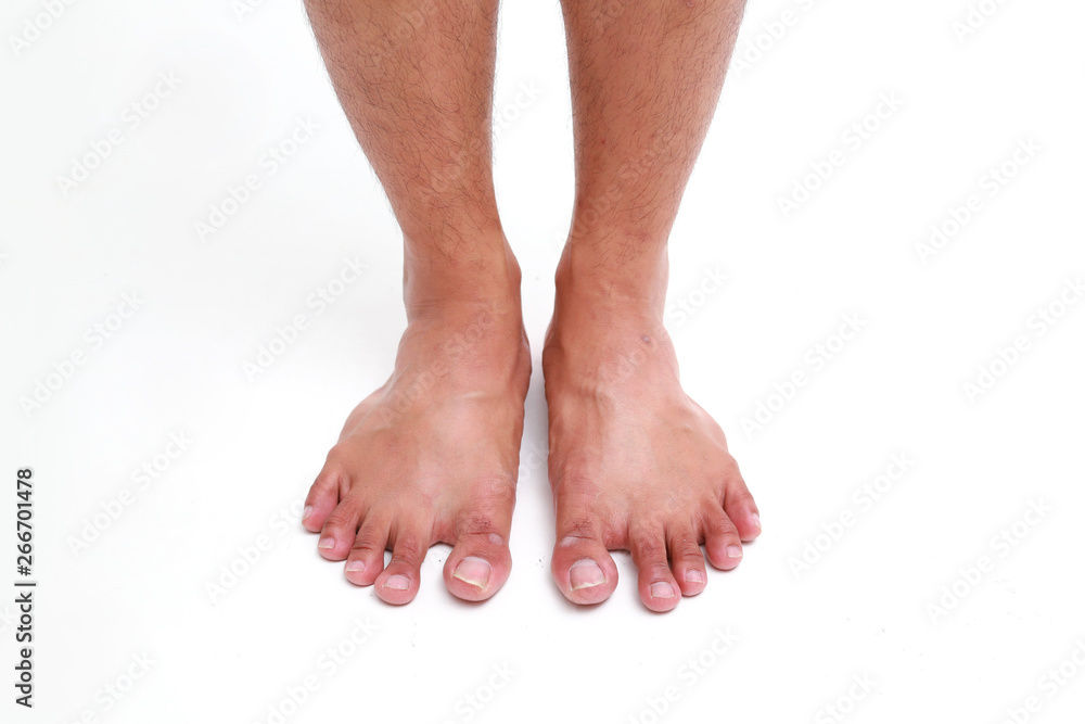 Closeup front view of men legs on white background, health care and medical concept. Closeup front view of men legs on white background, health care and medical concept.