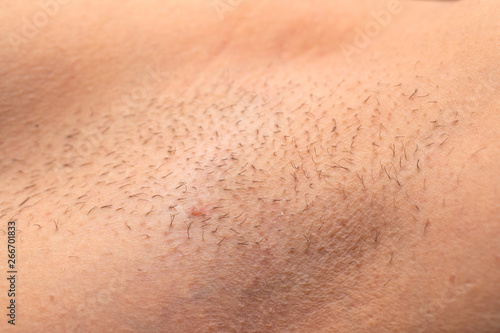 Photos Unshaved armpit close up
