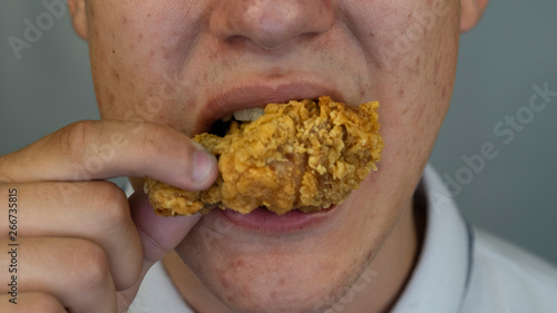 Boy with pimples and acne on face is eating fast food, close up © Aleksandr