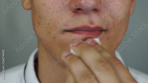 The young man wipes his lips with a wet wipe after eating. Close up