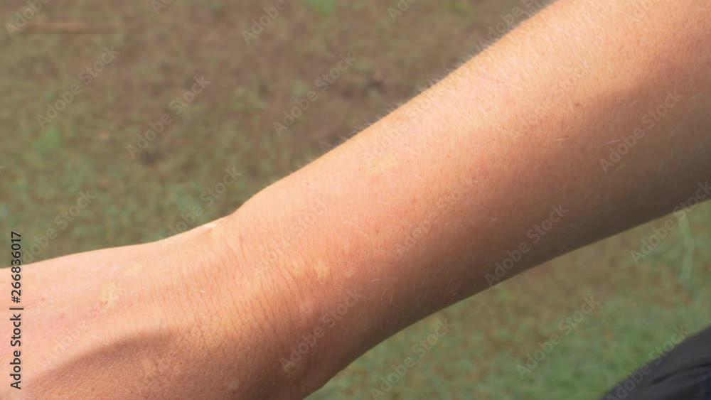 Vidéo Stock MACRO DOF Close up of a hand scratched by a kitten