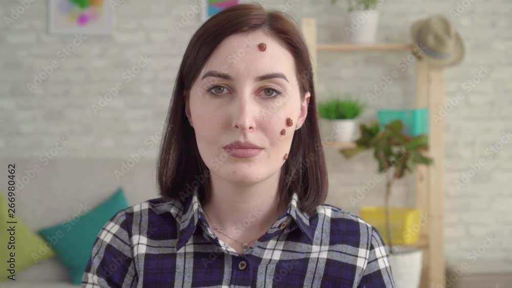 Portrait of a young attractive woman with big moles on her face Portrait of a young attractive woman with big moles on her face