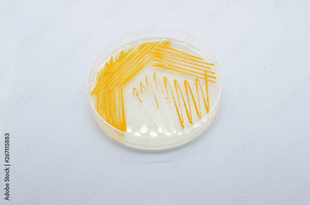 Orange colonies of Actinomyces bacteria on agar plate Orange colonies of Actinomyces bacteria on agar plate