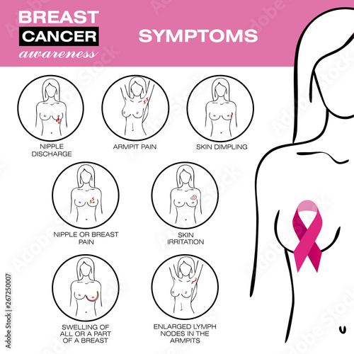 Symptoms of breast cancer. Healthcare poster or banner template. Medicine, pathology, anatomy, physiology, health. Info-graphic. Vector illustration.