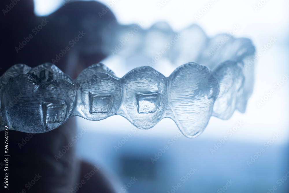 Invisible bracket teeth aligners Invisible bracket teeth aligners