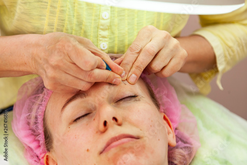 A young girl is lying on a couch during cosmetic procedures with a mask on the face which beautician woman squeezes body fat and pimples piercing the skin with a needle on eye. Cleansing and make up.