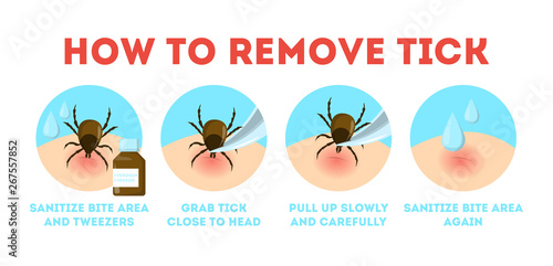 Tips for tick safety infographic. How to remove mite photo