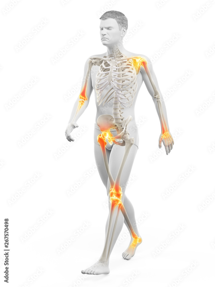 3d rendered medically accurate illustration of painful joints 3d rendered medically accurate illustration of painful joints