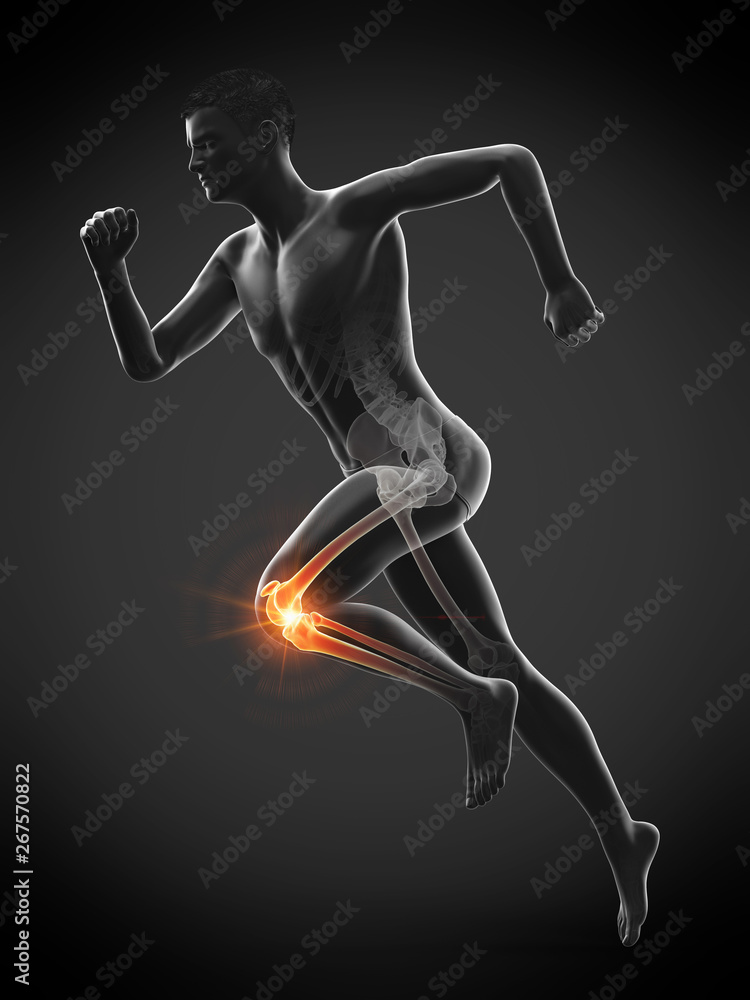 3d rendered medically accurate illustration of a runners painful knee 3d rendered medically accurate illustration of a runners painful knee