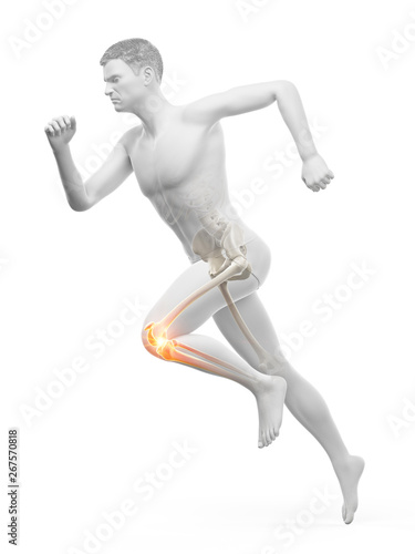 3d rendered medically accurate illustration of a runners painful knee