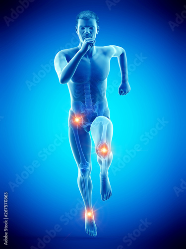 3d rendered medically accurate illustration of a runners painful joints © Sebastian Kaulitzki