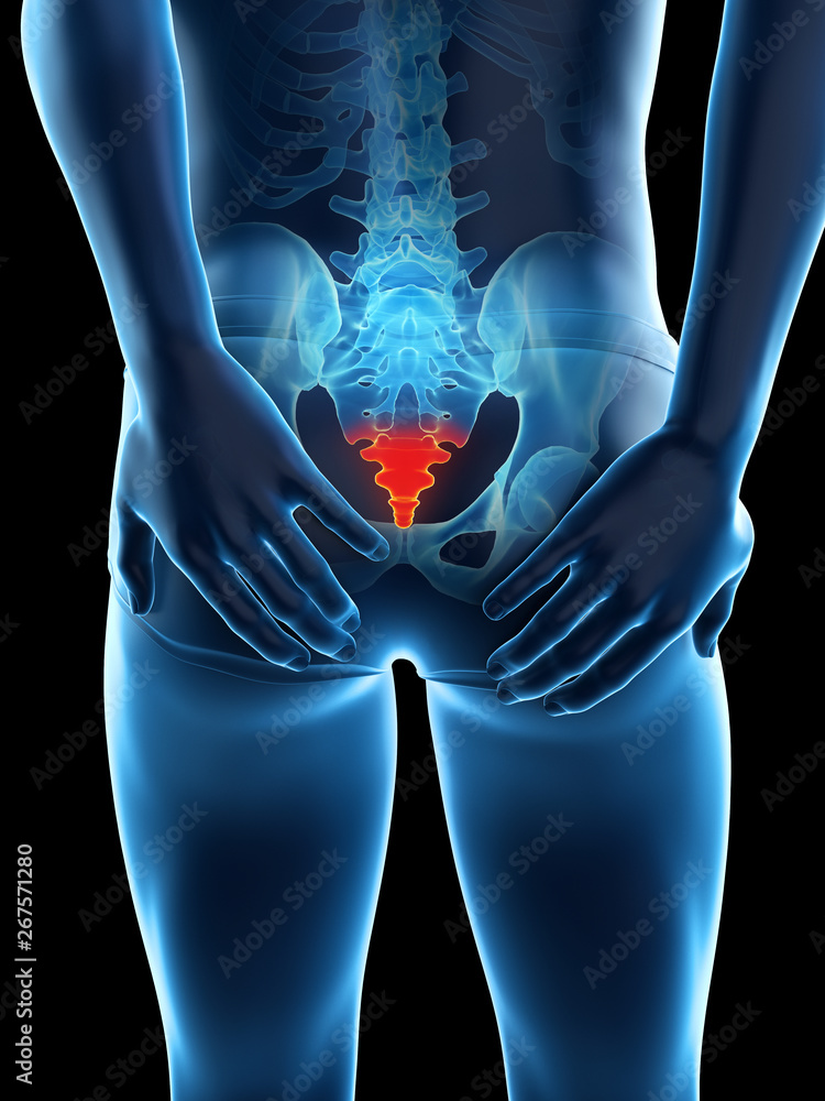 3d rendered medically accurate illustration of a painful tailbone - obrazy, fototapety, plakaty 