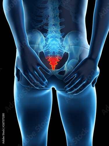 3d rendered medically accurate illustration of a painful tailbone photo