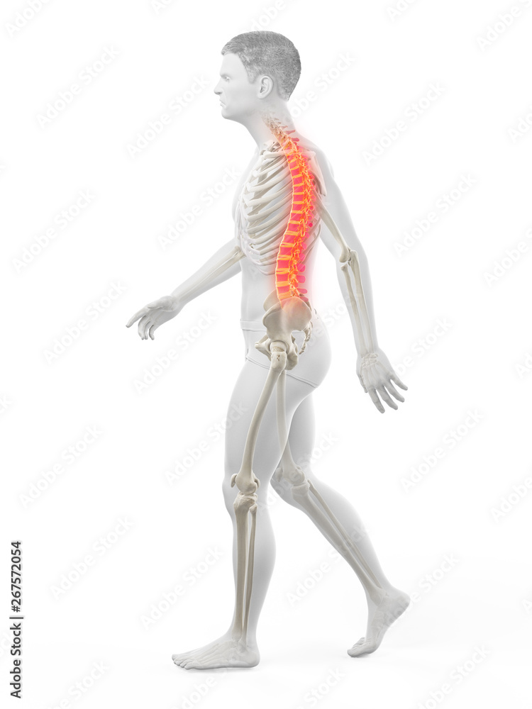 3d rendered medically accurate illustration of a painful back 3d rendered medically accurate illustration of a painful back