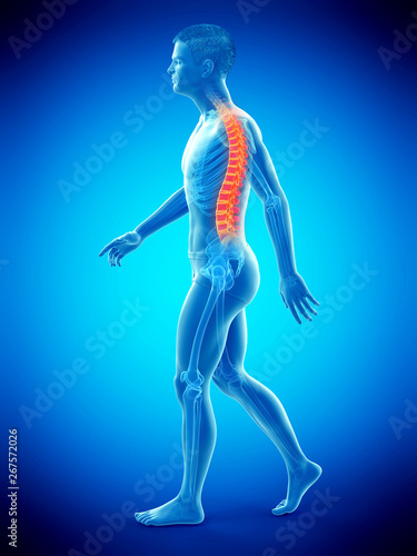 3d rendered medically accurate illustration of a painful back