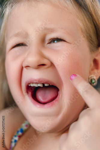 Little girl points the finger at a wobbly baby tooth