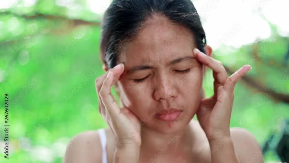 Young woman having a strong headache. Close up young woman with headache. Young woman having a strong headache. Close up young woman with headache.