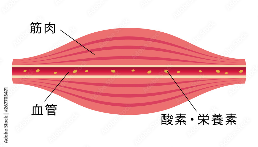 健康な筋肉 肩こり 凝り 痛みの発生イラスト Stock Vector Adobe Stock 健康な筋肉 肩こり 凝り 痛みの発生イラスト Stock Vector Adobe Stock