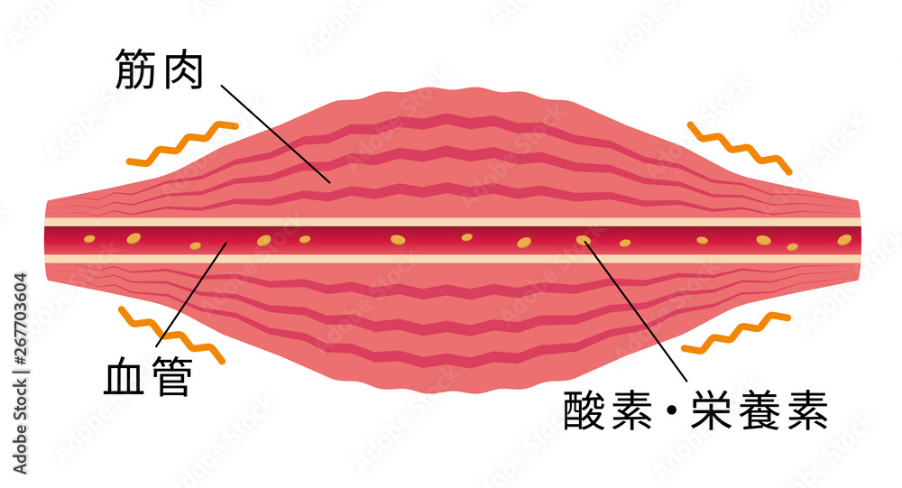 緊張・こわばった筋肉 / 肩こり・凝り・痛みの発生イラスト Stock 벡터 | Adobe Stock