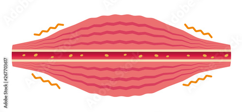 Muscle becomes tense (No text) . Flat illustration of muscle and vessel.