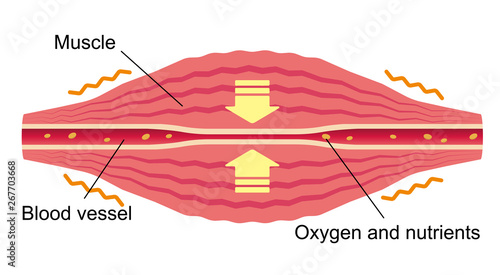 Blood vessel compressed. Flat illustration of muscle and vessel. 