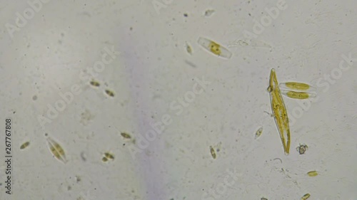 Diatoms in creek water photo