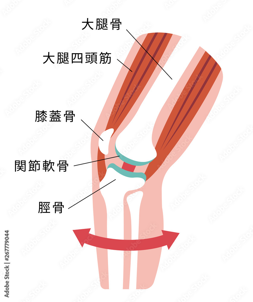 膝の関節痛 変形性膝関節症 発生の仕組みと原因 イラスト 健康な膝 Stock ベクター Adobe Stock
