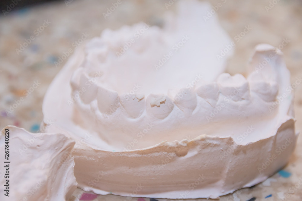 Plaster impression of teeth. Dental plaster mold. Dental mold showing teeth on a table viewed side on in a dentistry oral hygiene and healthcare concept Plaster impression of teeth. Dental plaster mold. Dental mold showing teeth on a table viewed side on in a dentistry oral hygiene and healthcare concept