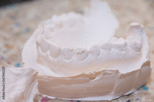 Plaster impression of teeth. Dental plaster mold. Dental mold showing teeth on a table viewed side on in a dentistry oral hygiene and healthcare concept