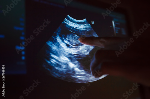 Snapshot of the dog's pregnancy on the monitor screen. Veterinarian points finger at the dog's pregnancy. Veterinary Concept. Veterinarian is doing ultrasound. View the puppy in the dog.