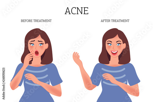Image concept of a girl with acne before and after treatment