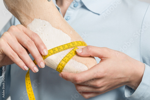 cloe up of female orthopedic shoemaker measuring a handmade wooden last