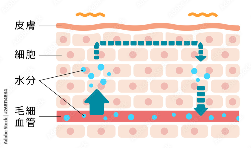 皮膚断面図イラスト むくみ 浮腫 の発生した皮膚 Stock Vector Adobe Stock