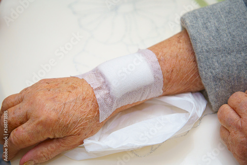 Close up old woman wrinkled skin hand or arm to the wounded waiting for nurse treatment.