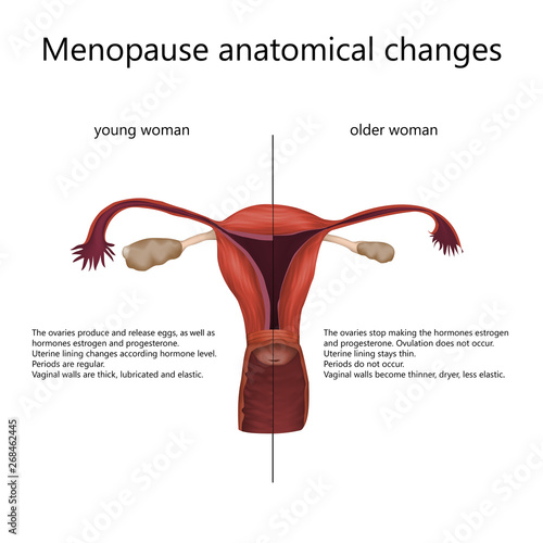 Menopause anatomical changes. Close up comparison of female reproductive system of young woman and older woman with explanations. Realistic anatomy vector illustration.