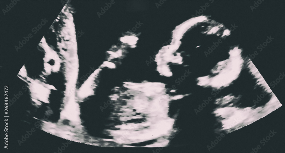 Obraz premium Ultrasound of baby inside mother's womb. Ultrasonography, echography of pregnant woman. Maternity and pregnancy concept
