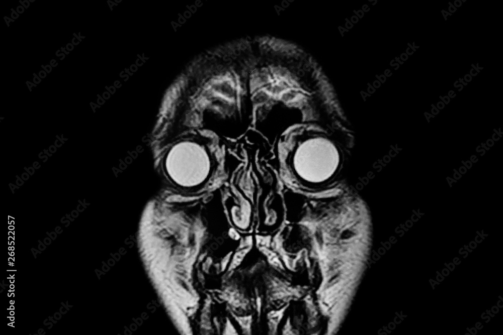 Obraz MRI image brain
