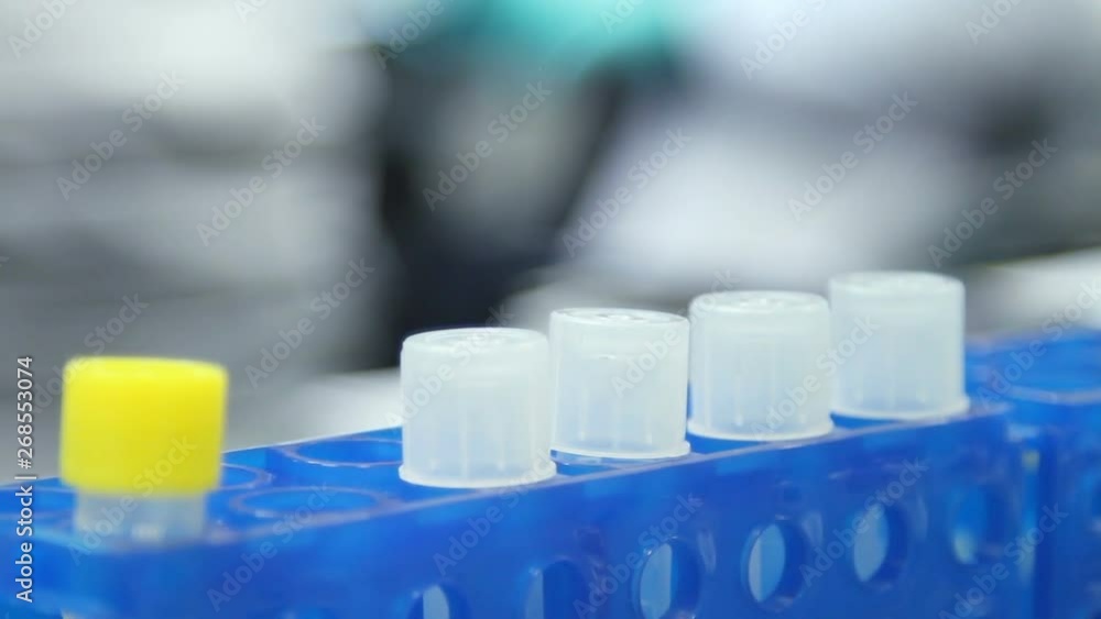 Close-up of a doctor inserts two test tubes with analyzes into a blue laboratory tripod. A gloved hand inserts white tubes into a tripod. Close-up of a doctor inserts two test tubes with analyzes into a blue laboratory tripod. A gloved hand inserts white tubes into a tripod.