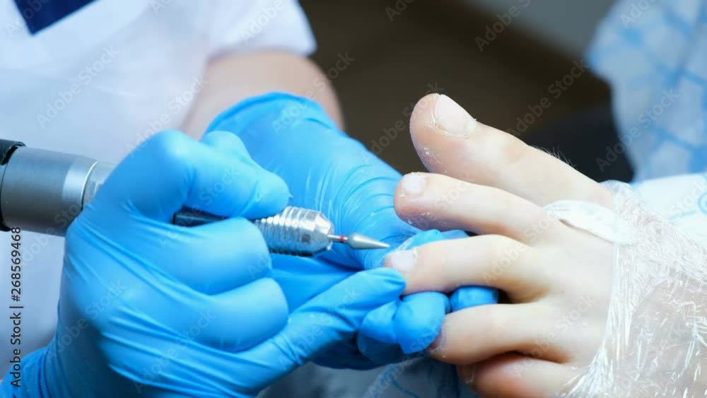 Apparatus pedicure - close-up of the skin around the nail, the master removes the cuticle Apparatus pedicure - close-up of the skin around the nail, the master removes the cuticle