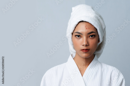 Comparison Portrait of Beautiful Asian woman. Dark spots and new skin, Before - After skin care and clean concept, Beauty treatment process of aging for rejuvenation. photo