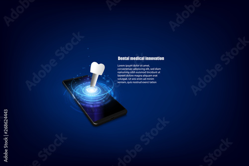 Doctor online medical app mobile, tooth implant dentistry technology.  vector illustation