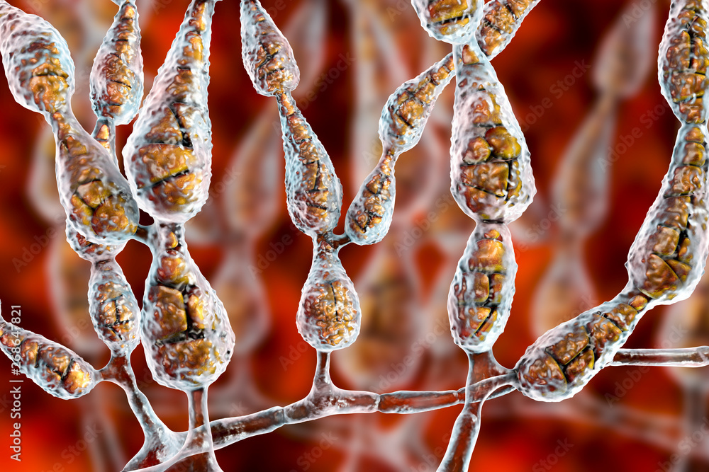 Alternaria Alternata