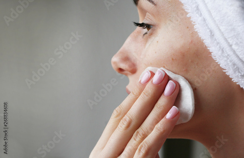girl with acne on face rubs face tonic photo