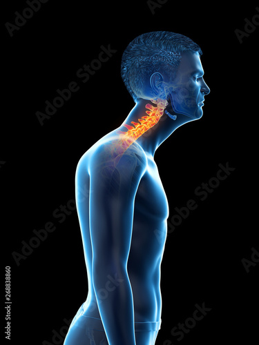 3d rendered medically accurate illustration of a man with a forward head posture