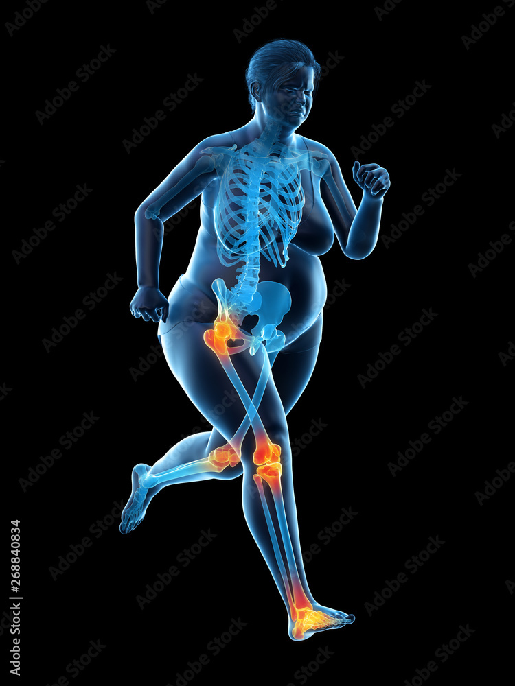 3d rendered medically accurate illustration of the painful joints of a running obese woman 3d rendered medically accurate illustration of the painful joints of a running obese woman