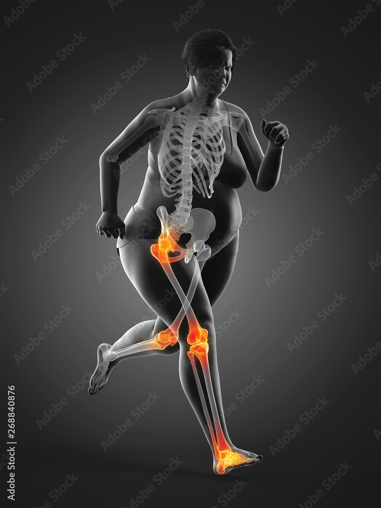 3d rendered medically accurate illustration of the painful joints of a running obese woman 3d rendered medically accurate illustration of the painful joints of a running obese woman