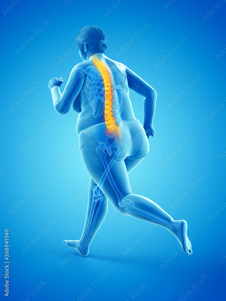 Fototapeta premium 3d rendered medically accurate illustration of the painful back of a running overweight woman