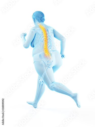 3d rendered medically accurate illustration of the painful back of a running overweight woman