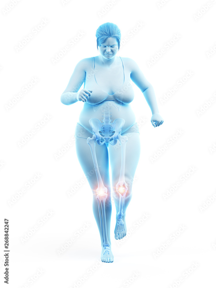 3d rendered medically accurate illustration of an overweight womans painful knees 3d rendered medically accurate illustration of an overweight womans painful knees