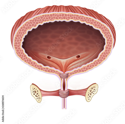 Ilustración anatómica y descriptiva de la vejiga con problemas de incontinencia urinaria, photo